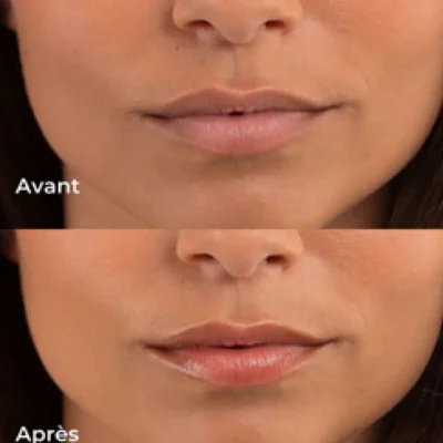 Baume lèvre teinté 10 ml – Les Petits Prodiges